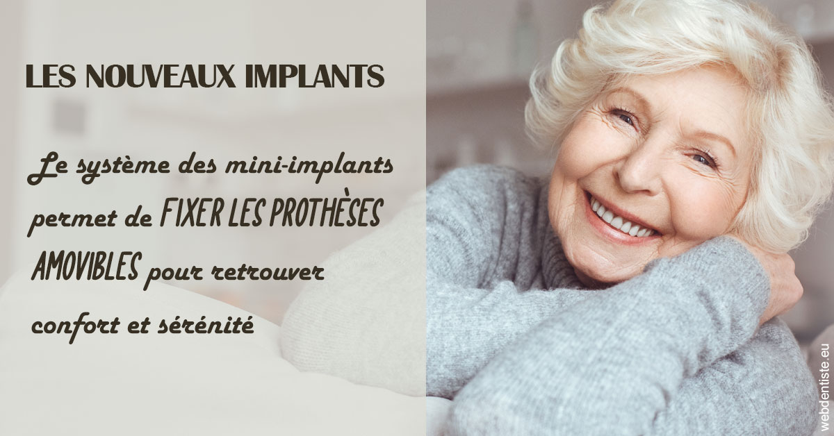 https://selarl-mardam.chirurgiens-dentistes.fr/Les nouveaux implants 1