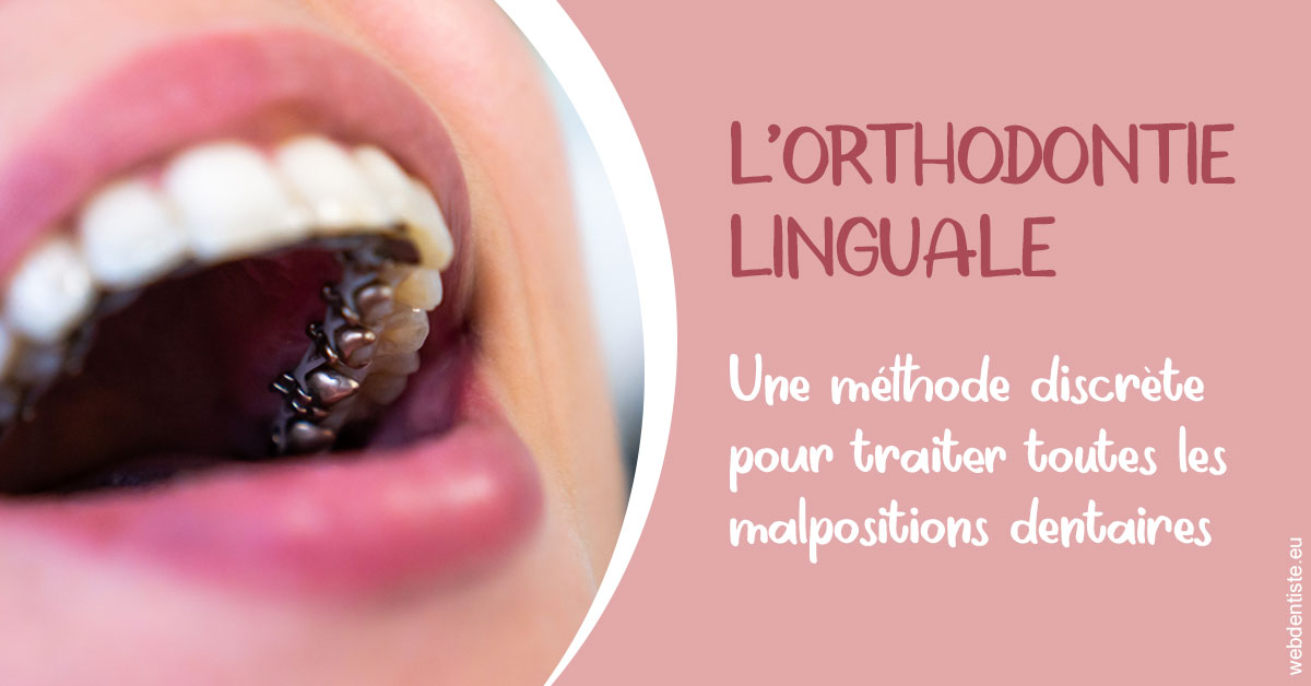 https://selarl-mardam.chirurgiens-dentistes.fr/L'orthodontie linguale 2