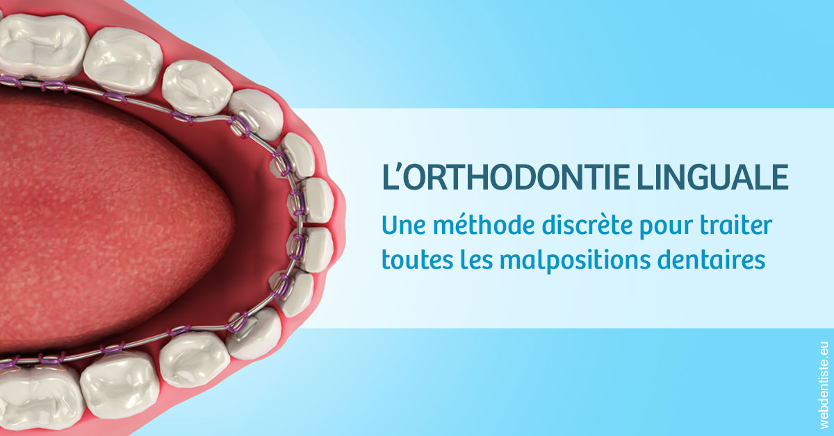https://selarl-mardam.chirurgiens-dentistes.fr/L'orthodontie linguale 1