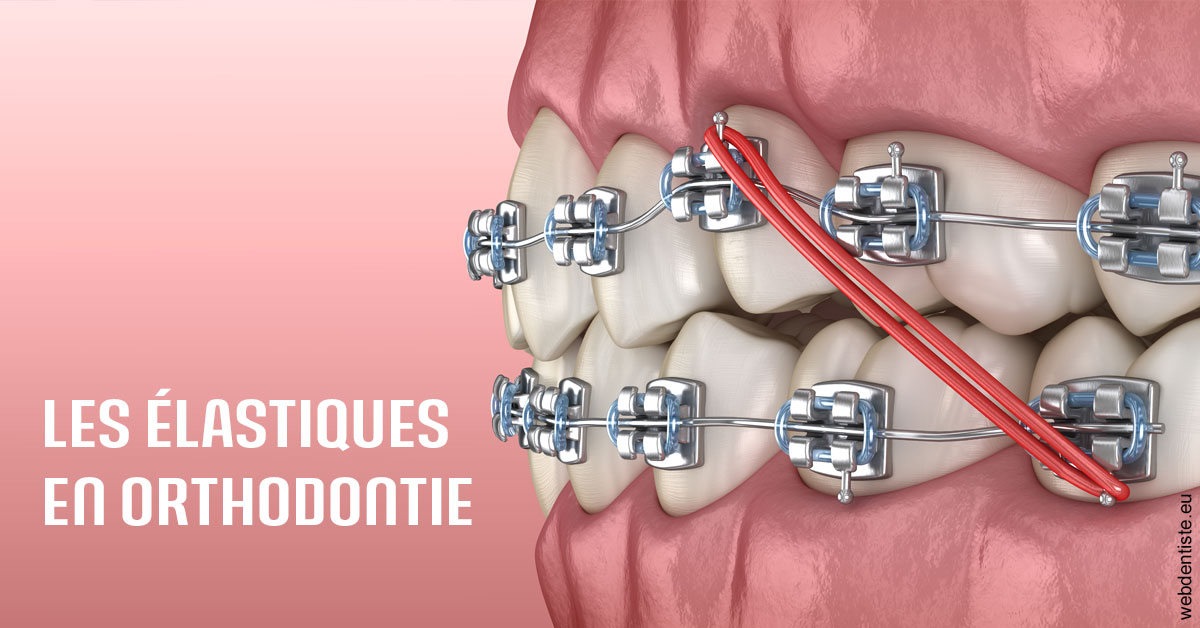 https://selarl-mardam.chirurgiens-dentistes.fr/Elastiques orthodontie 2