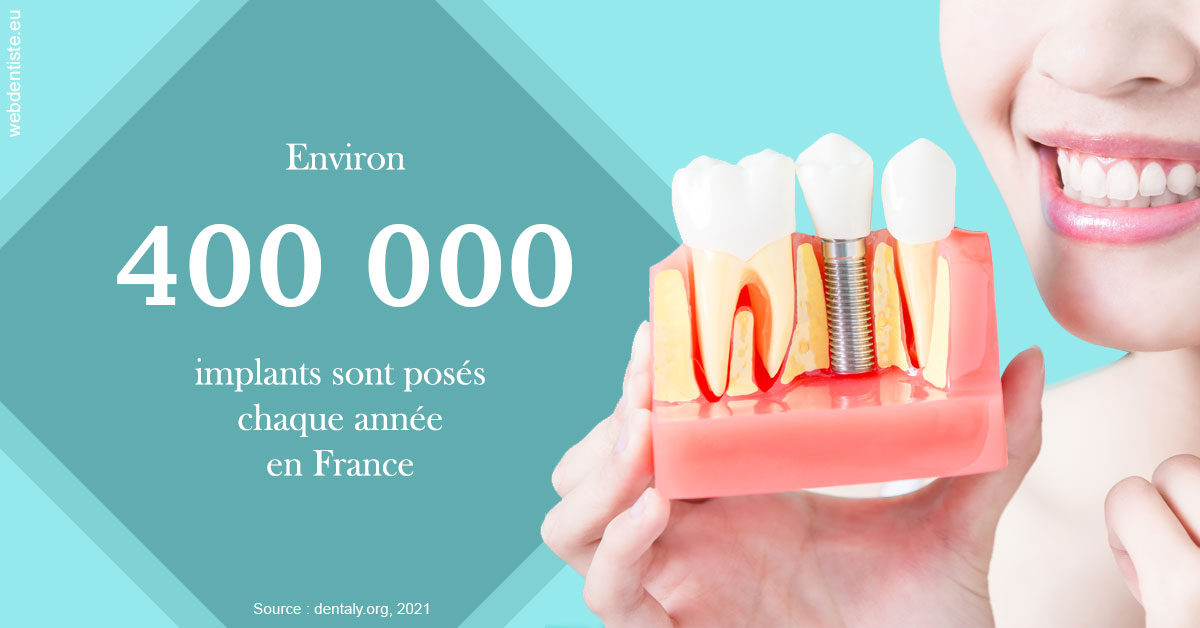 https://selarl-mardam.chirurgiens-dentistes.fr/Pose d'implants en France 2
